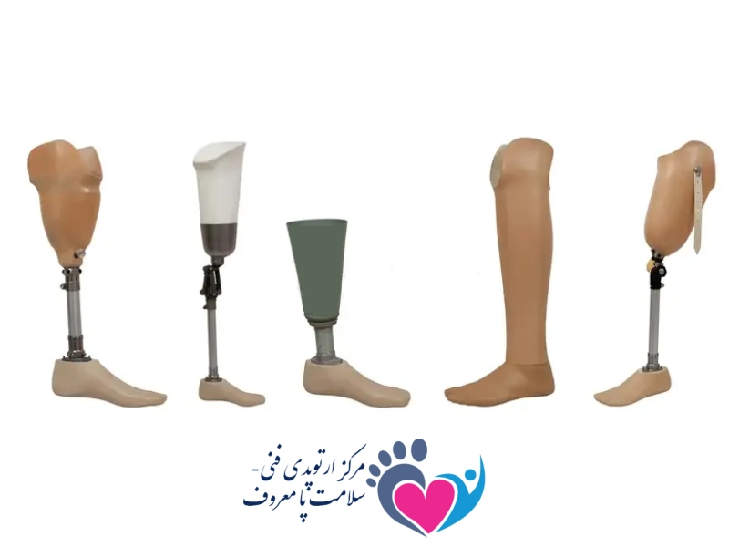 پروتز پا در اصفهان