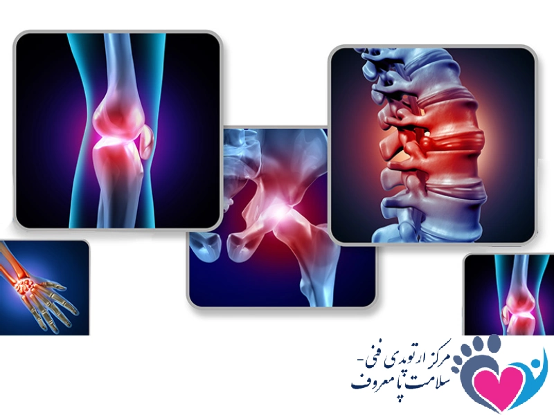 ناهنجاری اسکلتی عضلانی