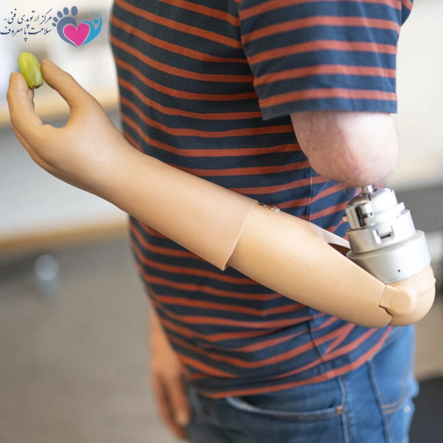 ساخت پروتز دست مصنوعی در اصفهان
