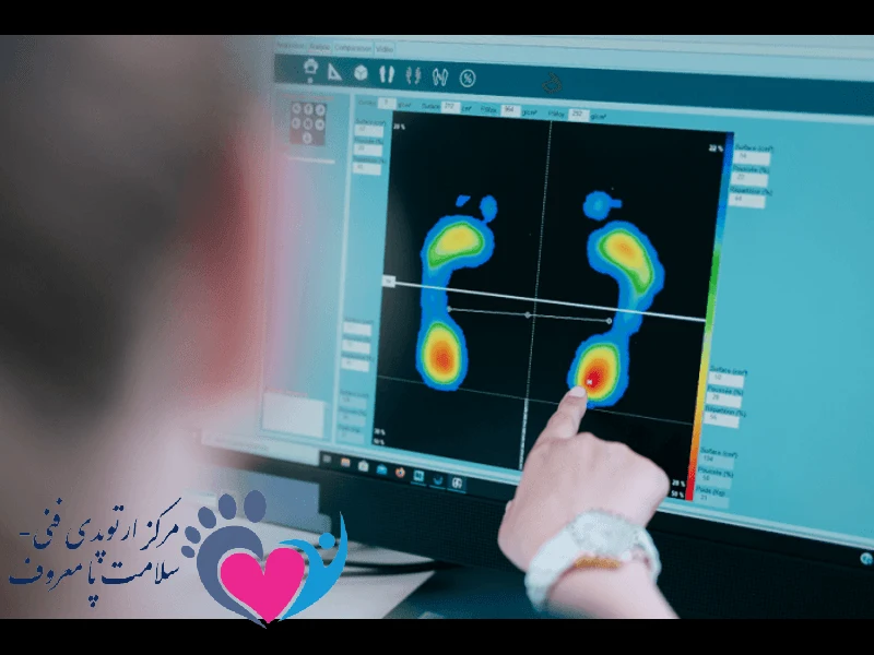 اسکن کف پا در اصفهان