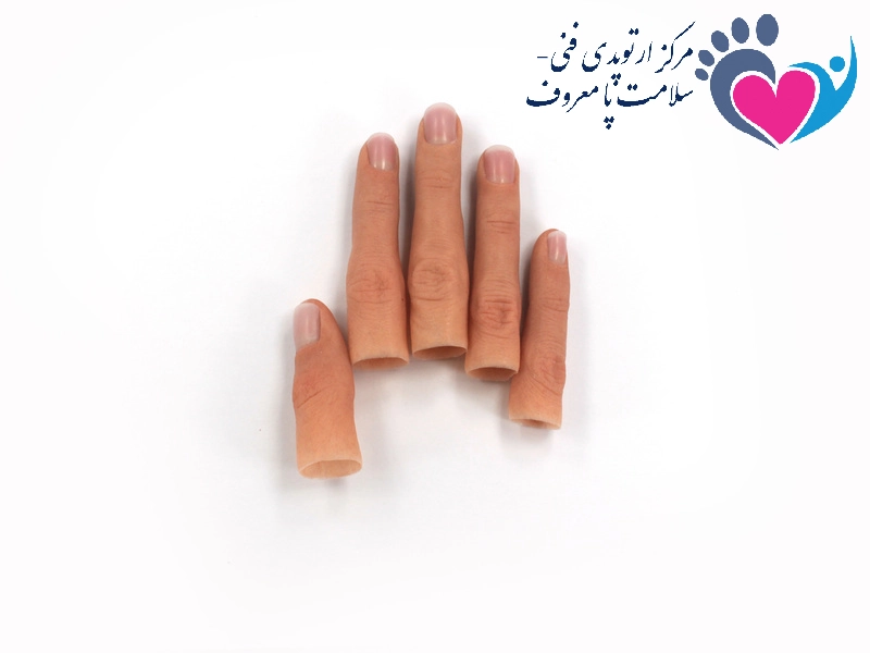پروتز انگشت