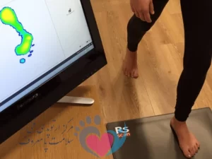 چرا اسکن کف پا اهمیت دارد؟