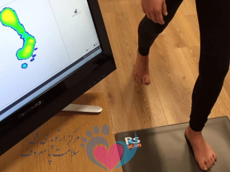 چرا اسکن کف پا اهمیت دارد؟